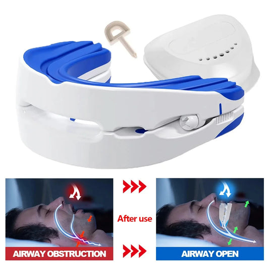 SilentRest Adjustable Anti-Snoring Mouthpiece