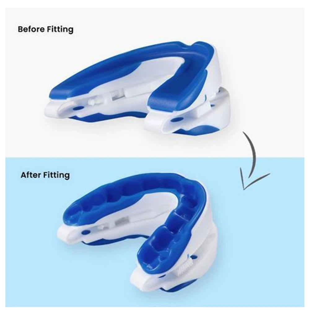 SilentRest Adjustable Anti-Snoring Mouthpiece