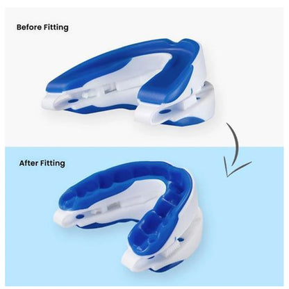 SilentRest Adjustable Anti-Snoring Mouthpiece